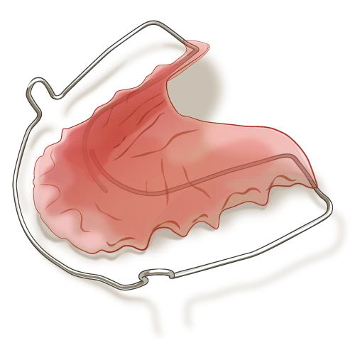 リテーナー(保定装置)のイラスト