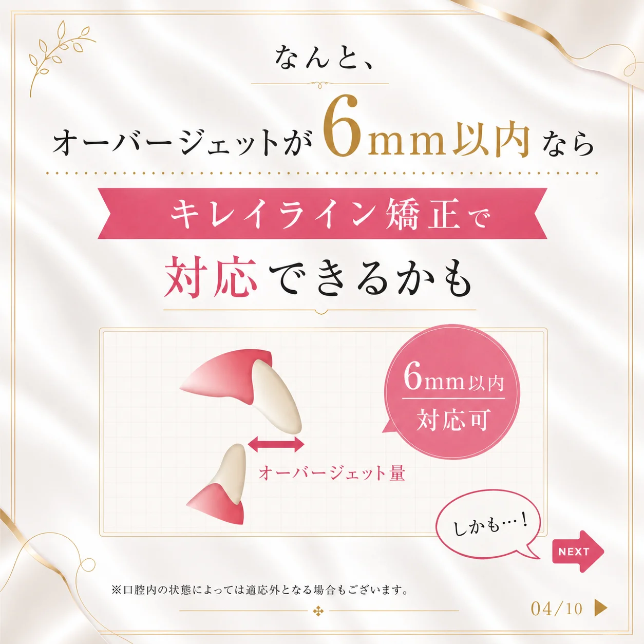 キレイライン矯正の症例 4