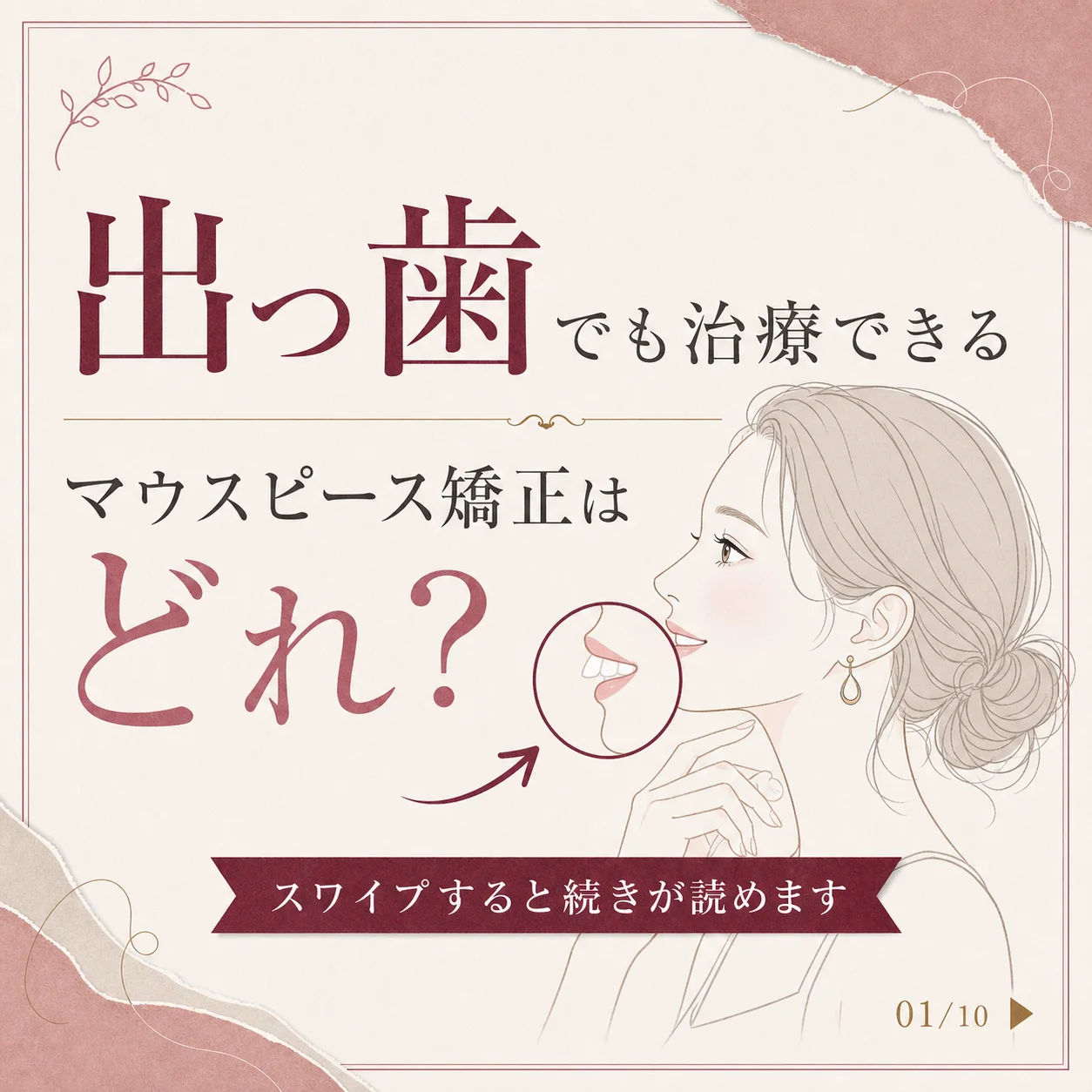 キレイライン矯正の症例 1