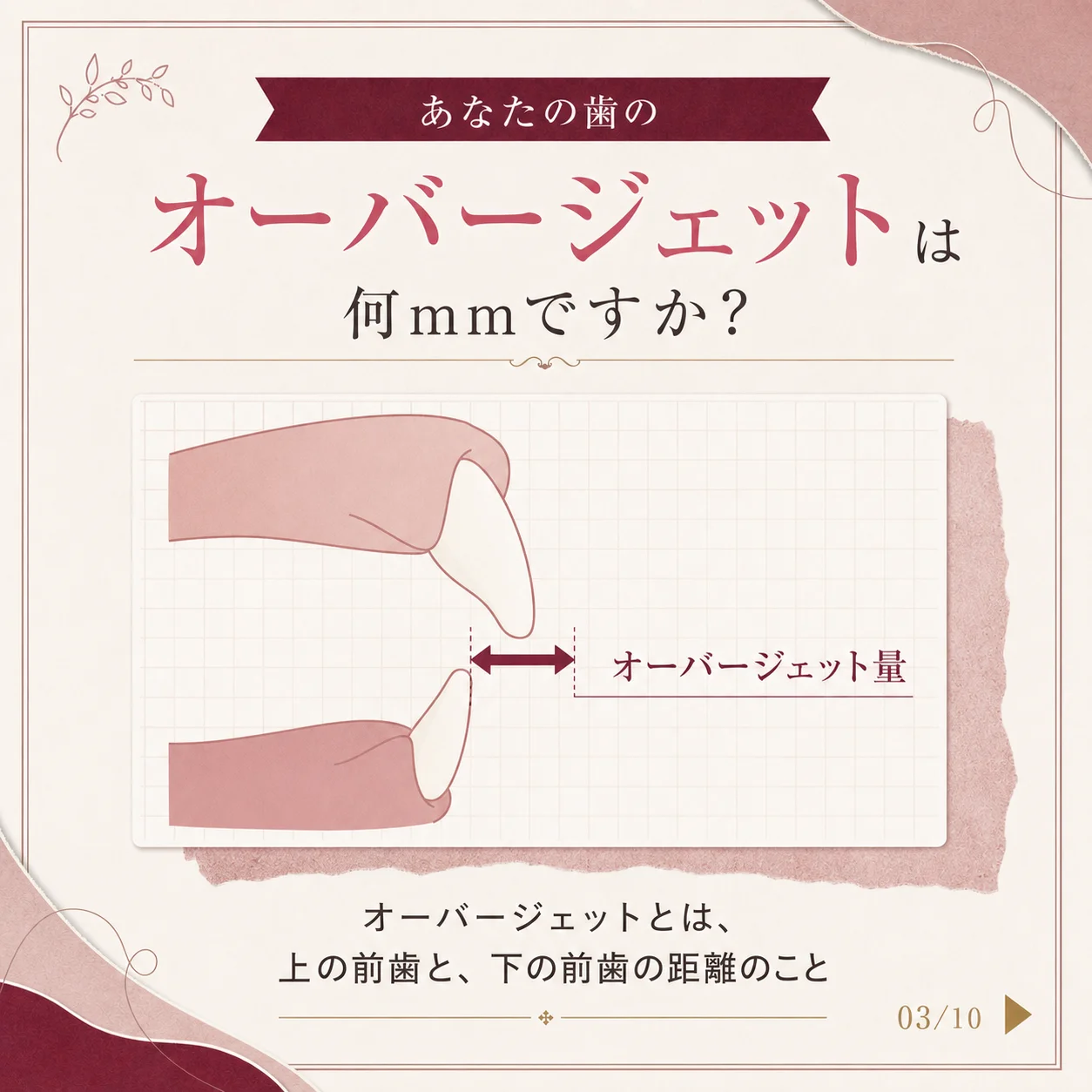 キレイライン矯正の症例 3