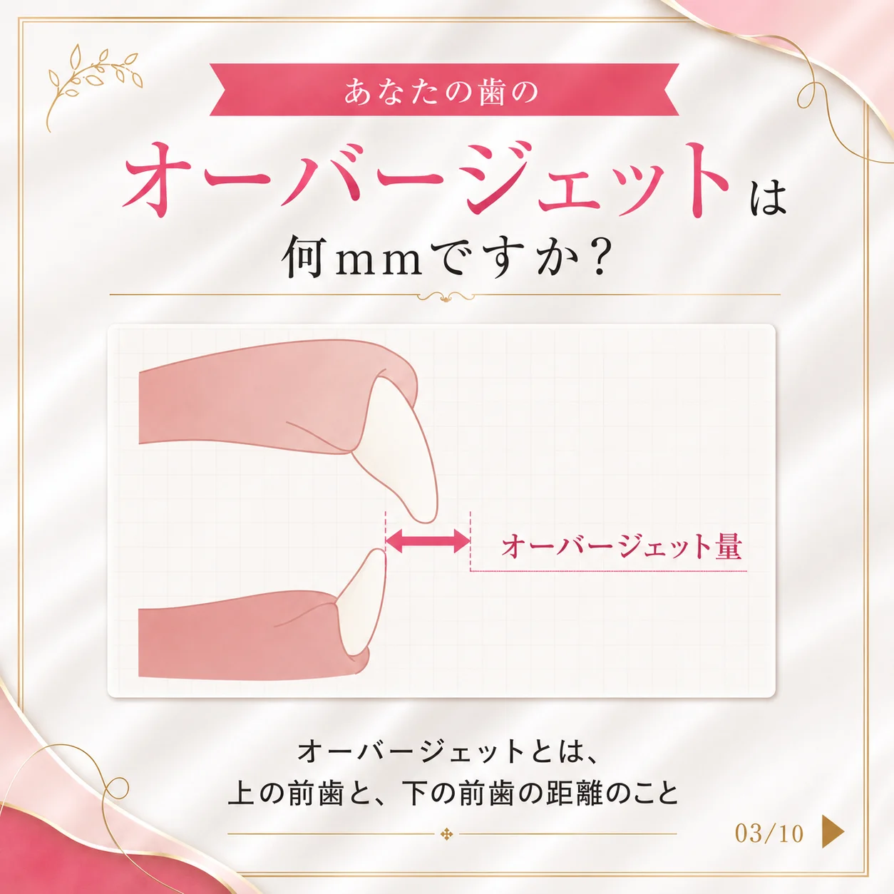 キレイライン矯正の症例 3