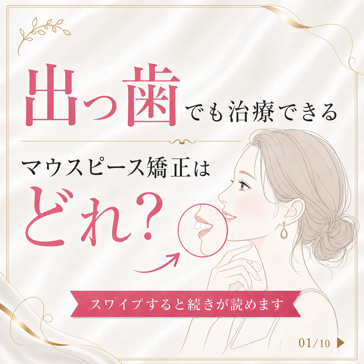 キレイライン矯正の症例 1