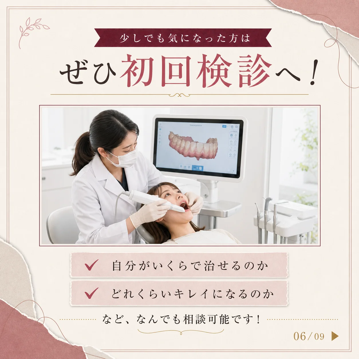 マウスピース矯正の基礎知識 6