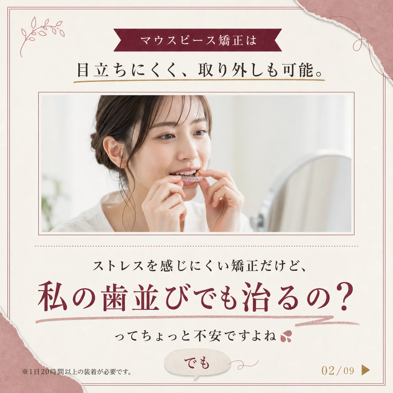 マウスピース矯正の基礎知識 2