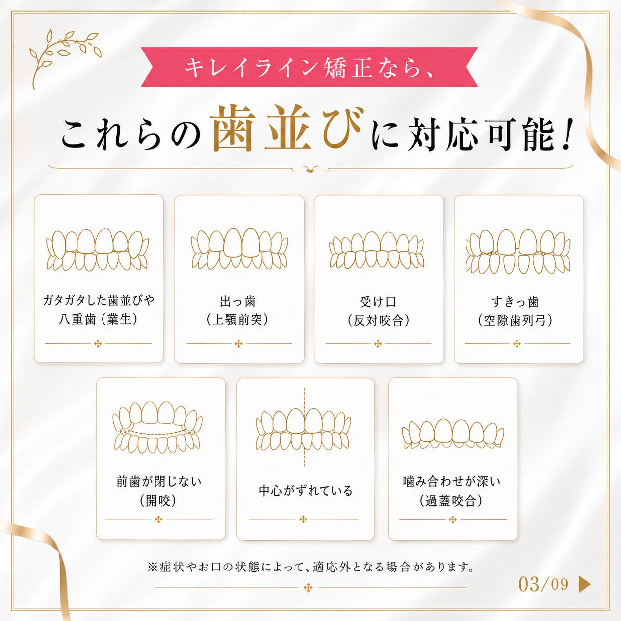 マウスピース矯正の基礎知識 3