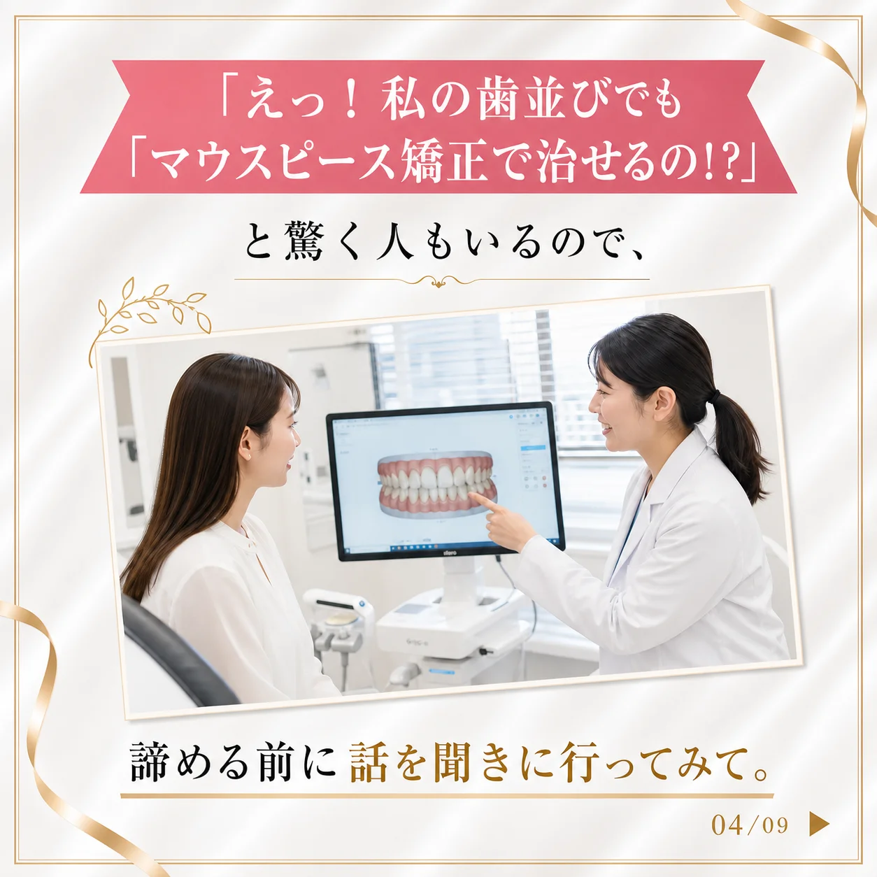 マウスピース矯正の基礎知識 4