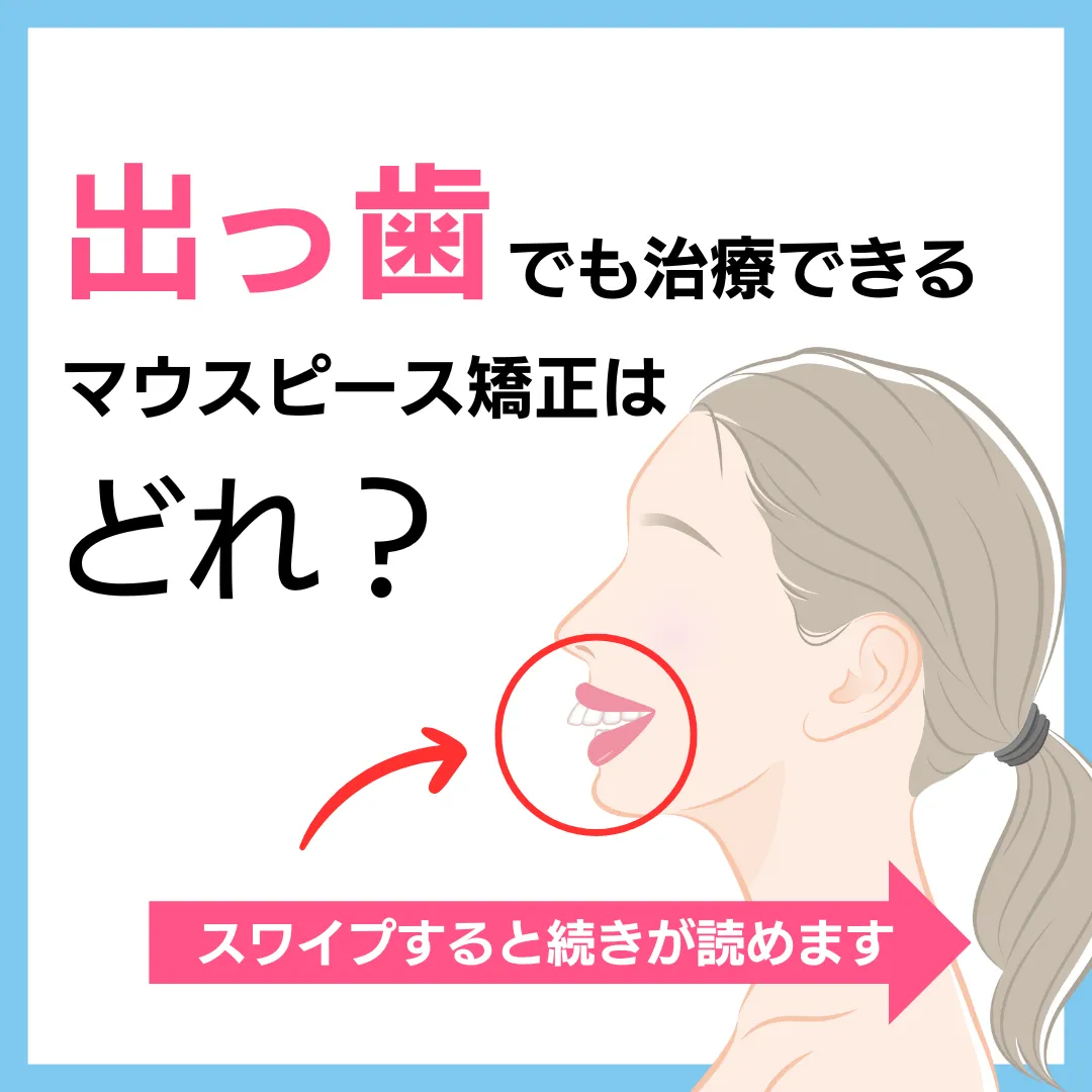 キレイライン矯正の症例 1