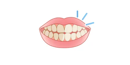 ホワイトニングに興味がある