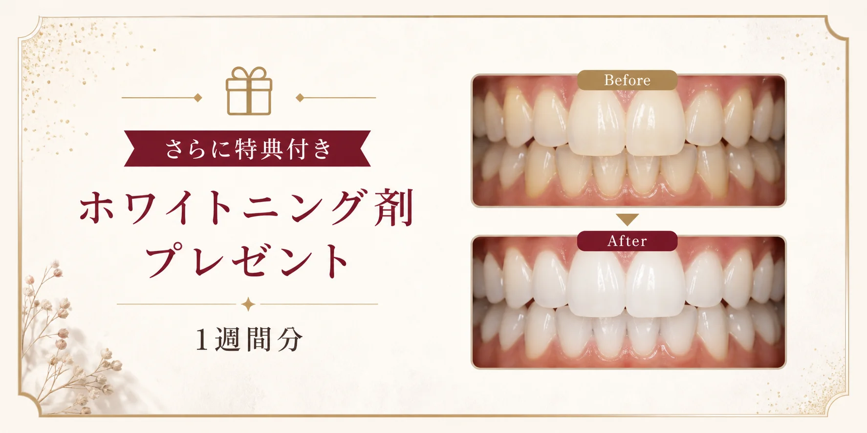 さらに特典付き ホワイトニング剤プレゼント 1週間分