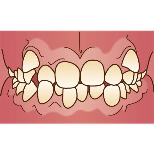 orthodontics033