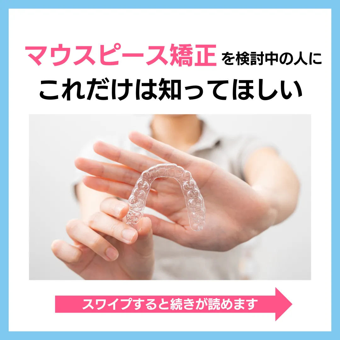 マウスピース矯正を検討中の人にこれだけは知ってほしい1
