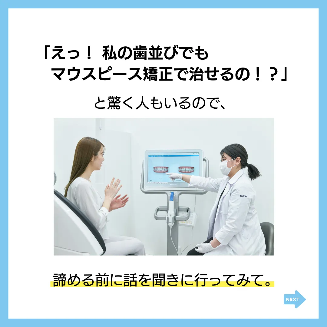 マウスピース矯正を検討中の人にこれだけは知ってほしい4