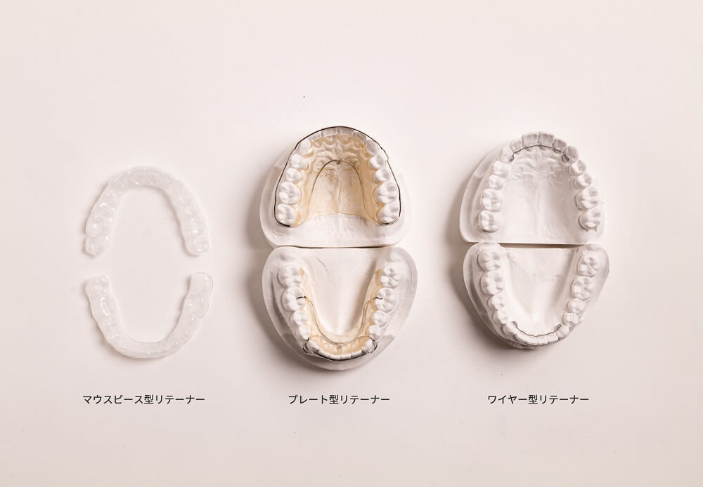 きちんと知りたい リテーナーの基本知識 キレイライン矯正の総仕上げ キレイライン矯正