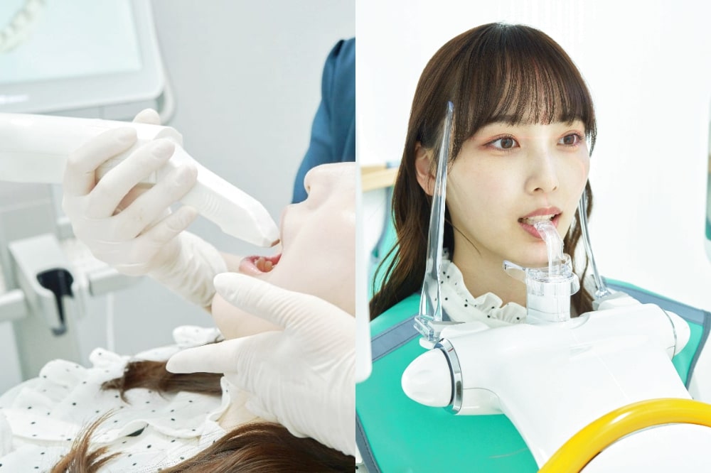 口腔内スキャナーと歯科用CT