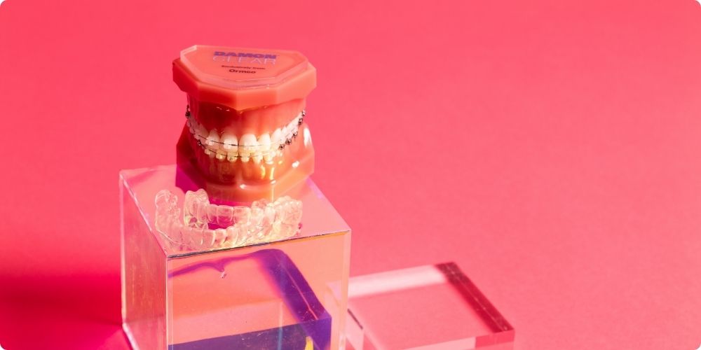 ワイヤー矯正に比べて痛みを感じにくい