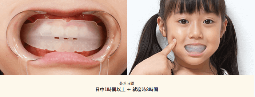 口呼吸が歯並びを悪くする 子供からの癖が口ゴボの原因にもなりかねない理由や改善方法 キレイライン矯正