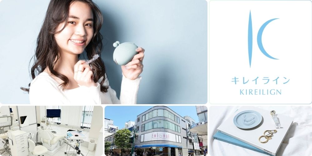 静岡県でキレイライン矯正を始めてみませんか？