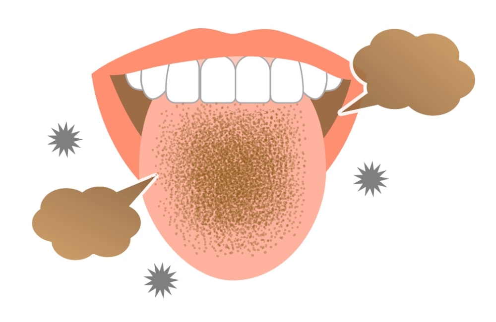 乳首の乾燥と妊娠