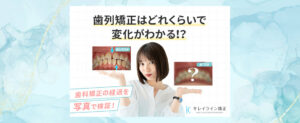 歯列矯正ってどれくらいで変化がわかる？4ヶ月～1年超の症例写真で検証！