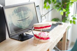 すきっ歯を歯列矯正で治したい！治療方法・費用・期間まで詳しくご紹介