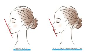 Eラインとは│バランスが崩れる原因・横顔美人になる方法