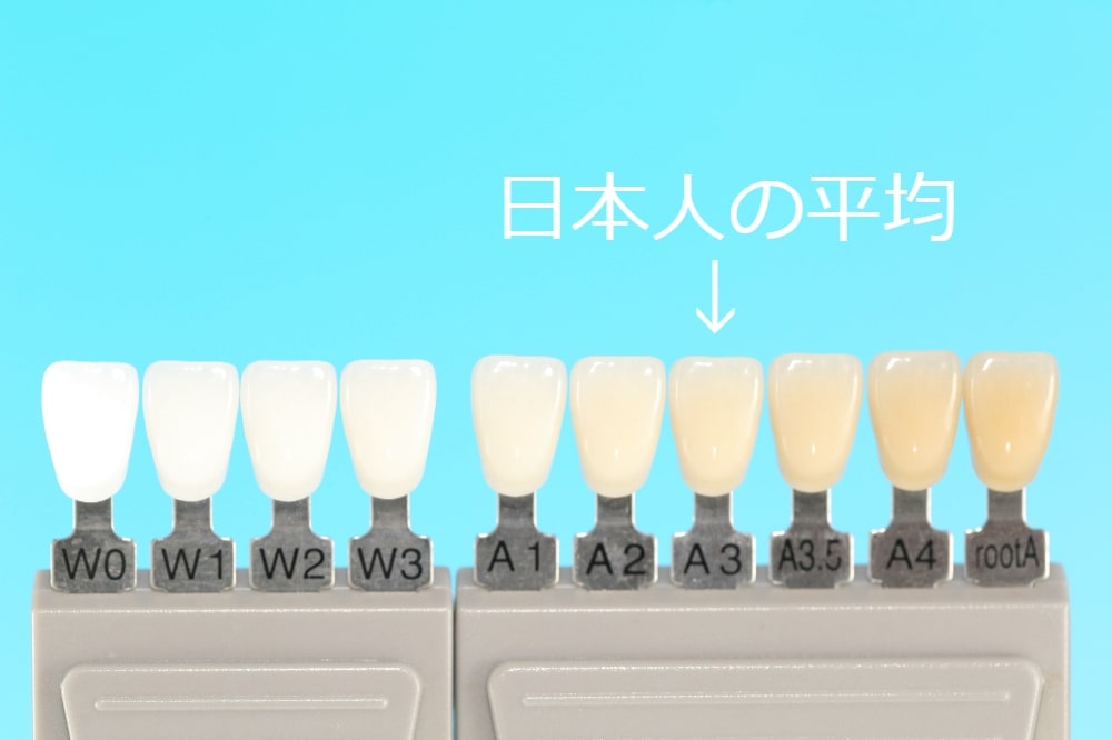 日本人の平均的な歯の色（A3）