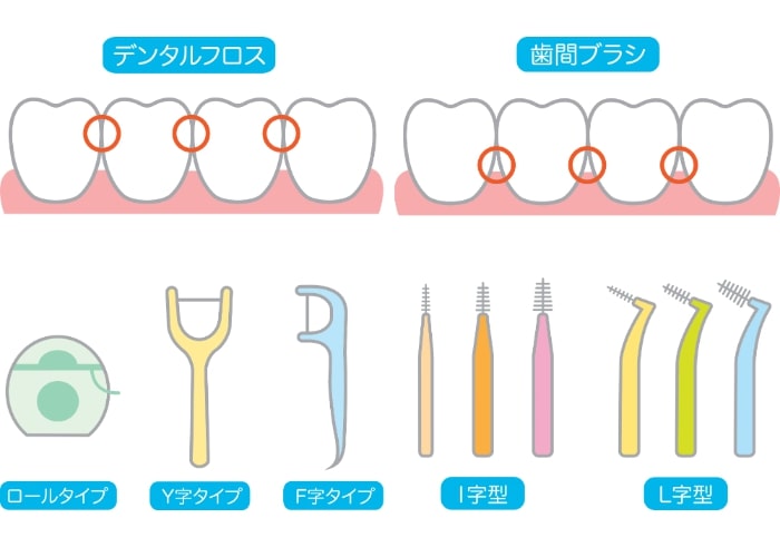 デンタルフロスと歯間ブラシ