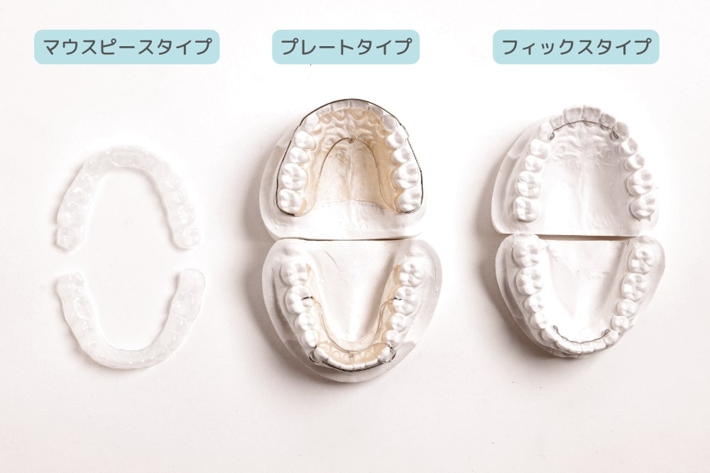 リテーナー3種類