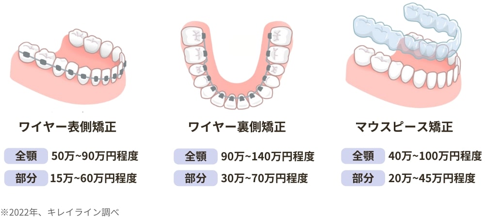 ワイヤー矯正とマウスピース矯正の費用相場