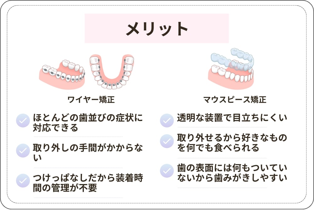 ワイヤー矯正とマウスピース矯正のメリット