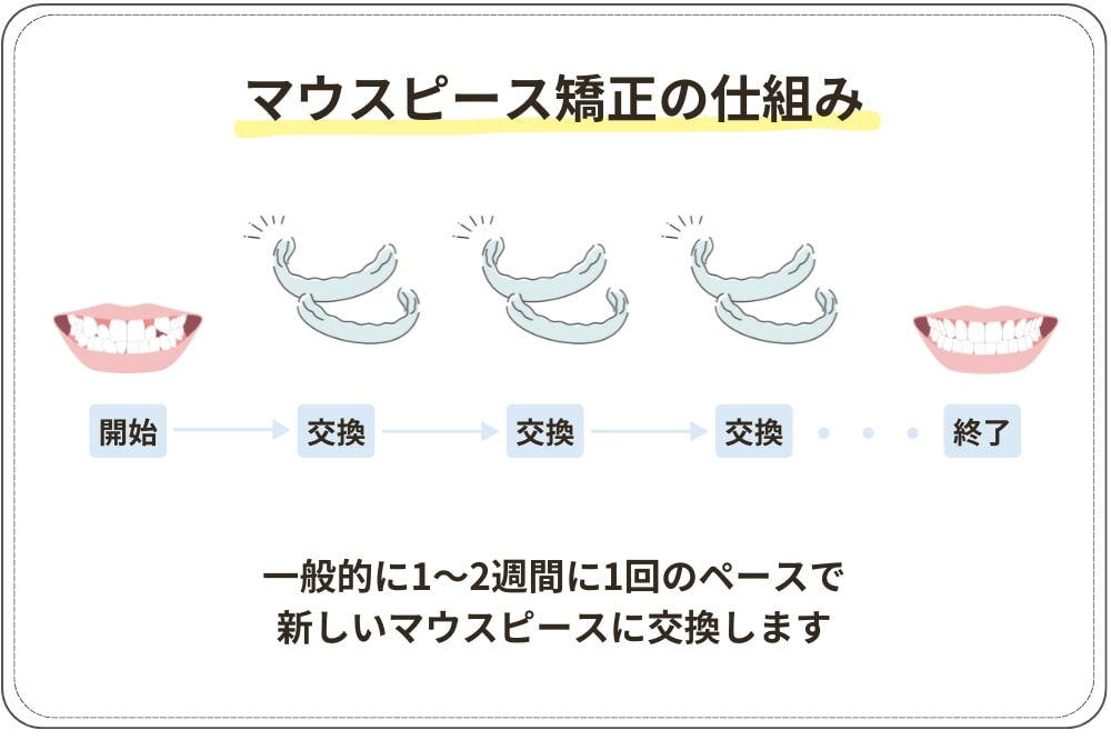 マウスピース矯正の仕組み