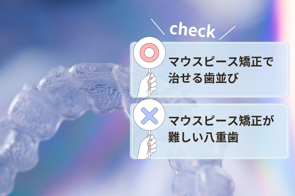 八重歯（叢生）でもマウスピース矯正できる？