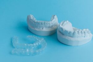 マウスピース矯正の仕組みとは？歯並びが変わるメカニズムを図解でわかりやすく紹介