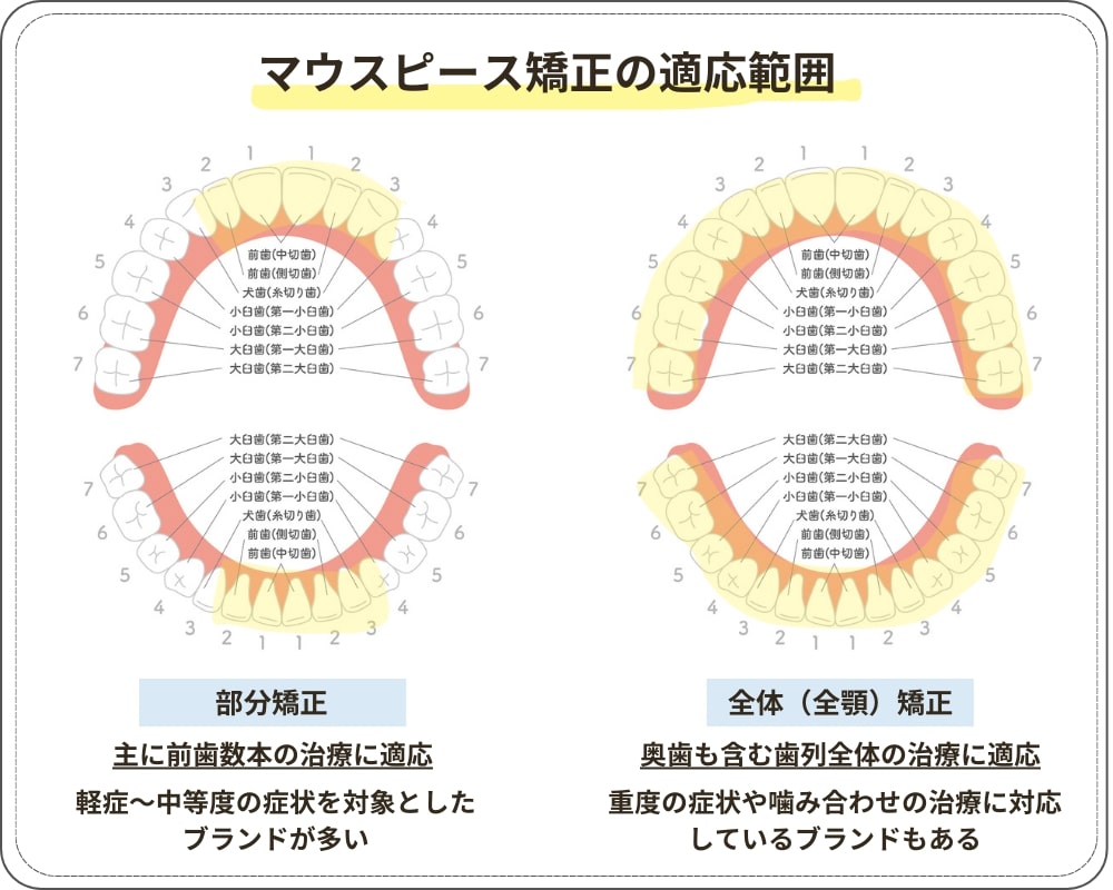 マウスピース矯正の適応範囲